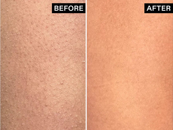 Glycolic_Body_Stick_Gallery_840x630_9d10b875-8369-46ee-aa0b-5bc11164dde7.webp