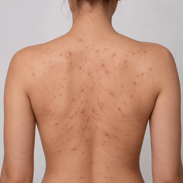 Stick Exfoliant pentru Corp