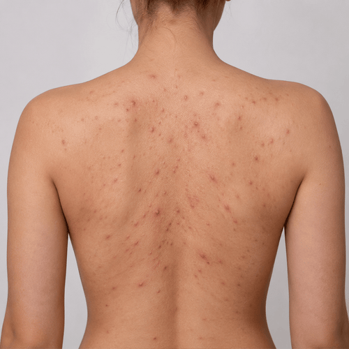 Stick Exfoliant pentru Corp